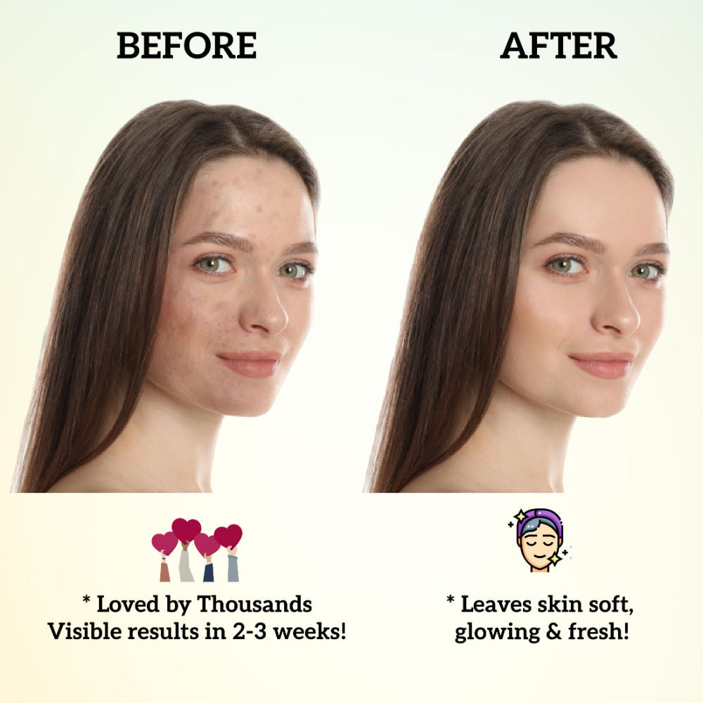 Sandal Face Wash, Removes Tan & Brightens, Gentle & Hydrating, for All Skin Types