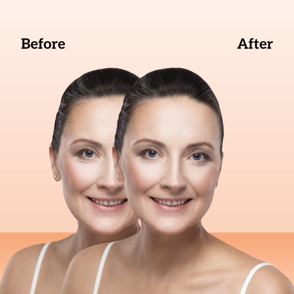 Retinol Night Cream, 1% Retinol & Bakuchiol, Anti-Aging, Hyaluronic Acid & Soya Peptides