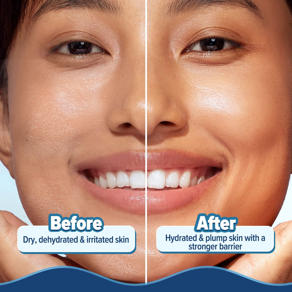 Barrier+ Hydra Gel Moisturizer With 5 Ceramides & Avocado For 24 Hour Intense Hydration