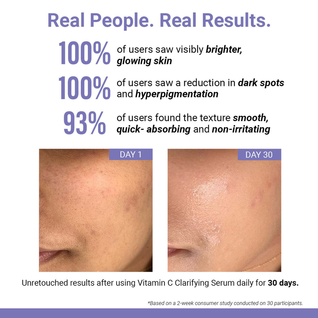 Vitamin C Clarifying Serum With Niacinamide For Glowing Skin, Fades Hyperpigmentation