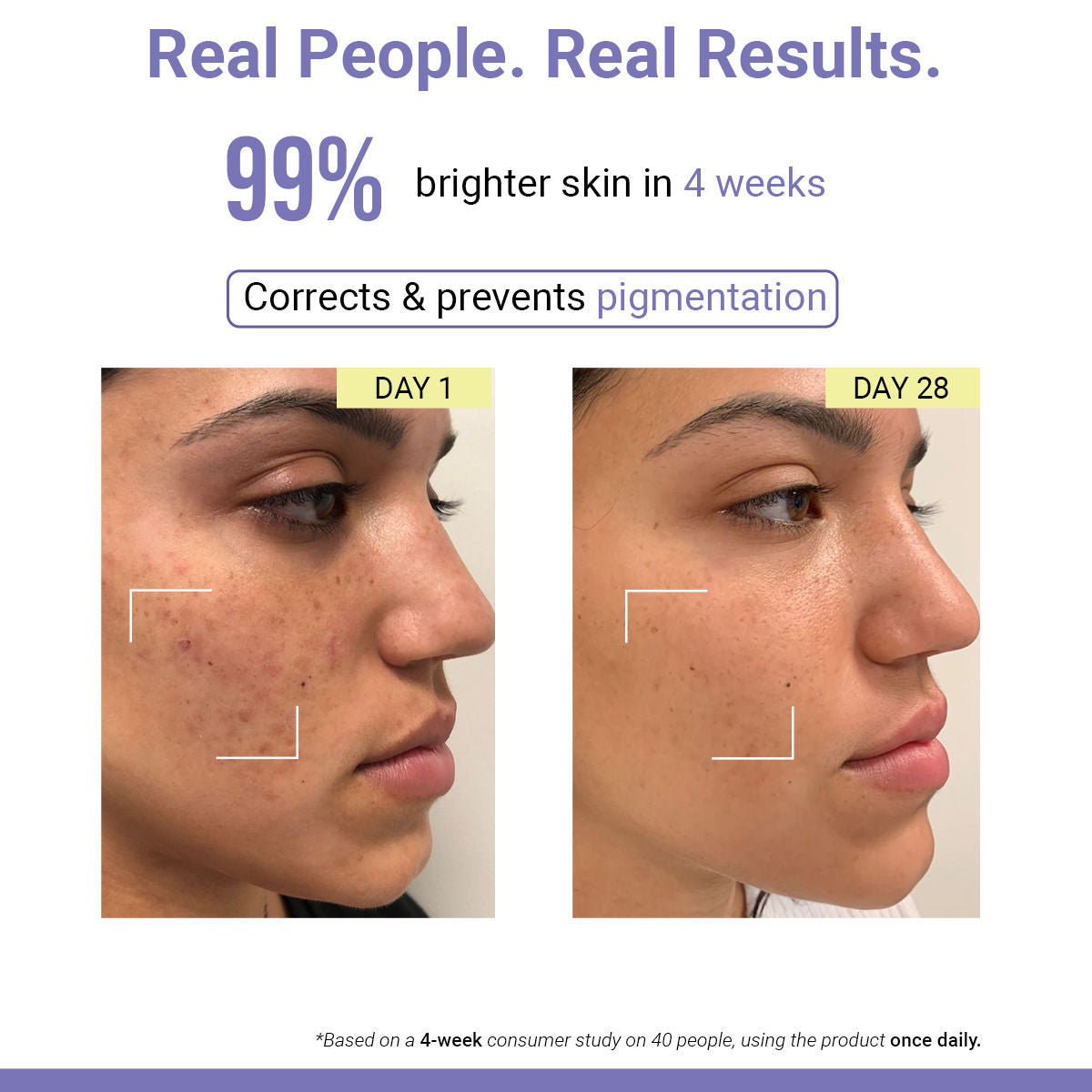 Vit C Night Cream with Niacinamide for Tan Removal & Pigmentation