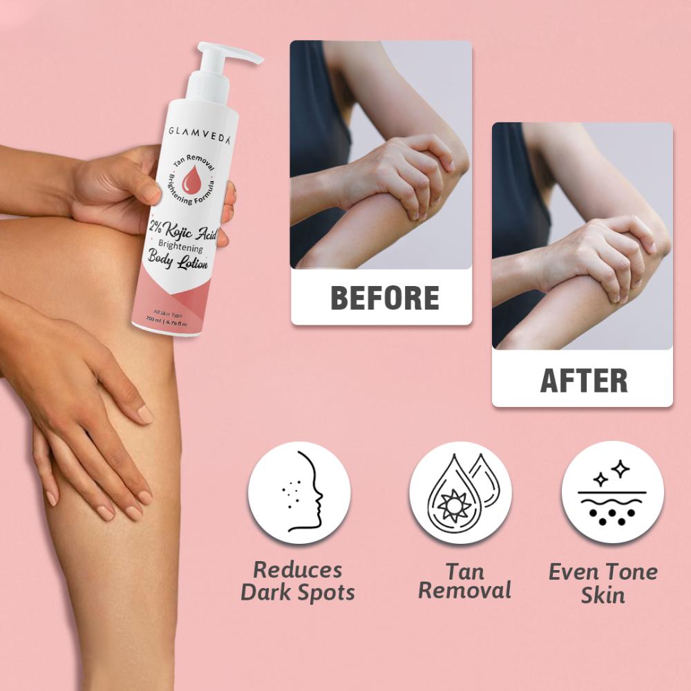 2% Kojic Body Lotion Advanced Pigmentation Care With Radiance Boosting Hydration