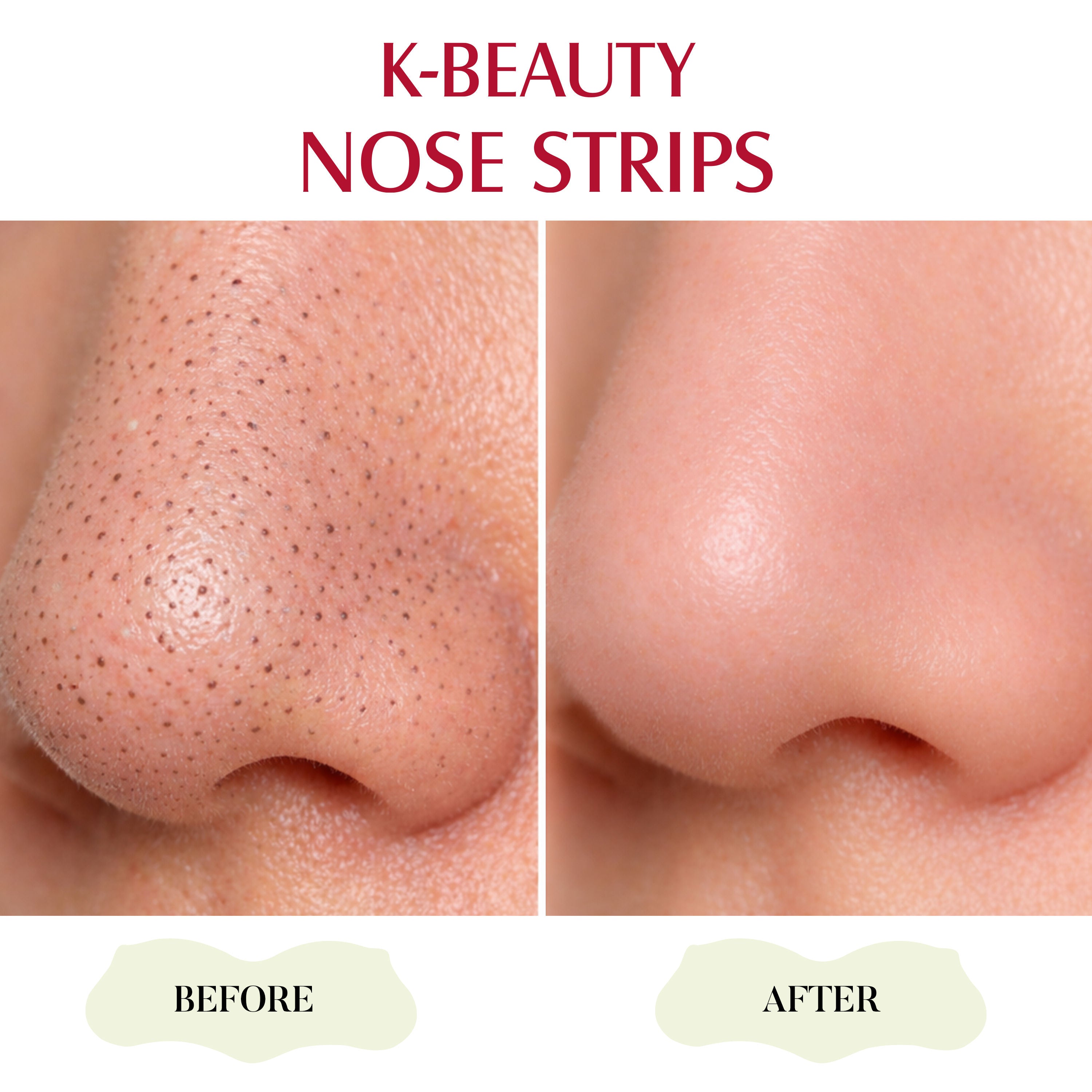 K-Beauty Nose Strips - Aloe Vera