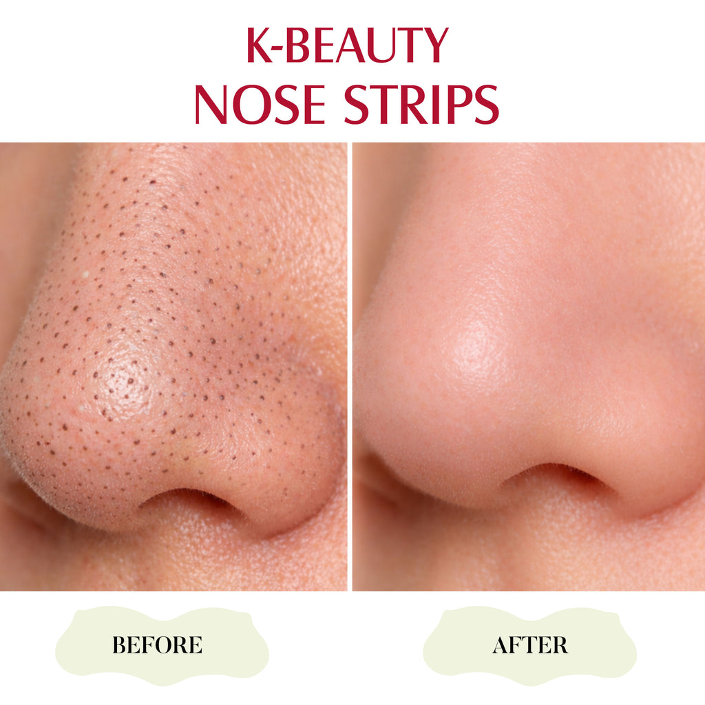 K-Beauty Nose Strips - Witch Hazel