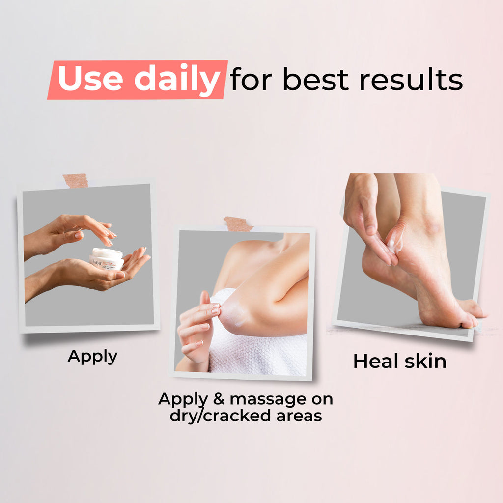 Deep Nourish Elbow & Foot Cream