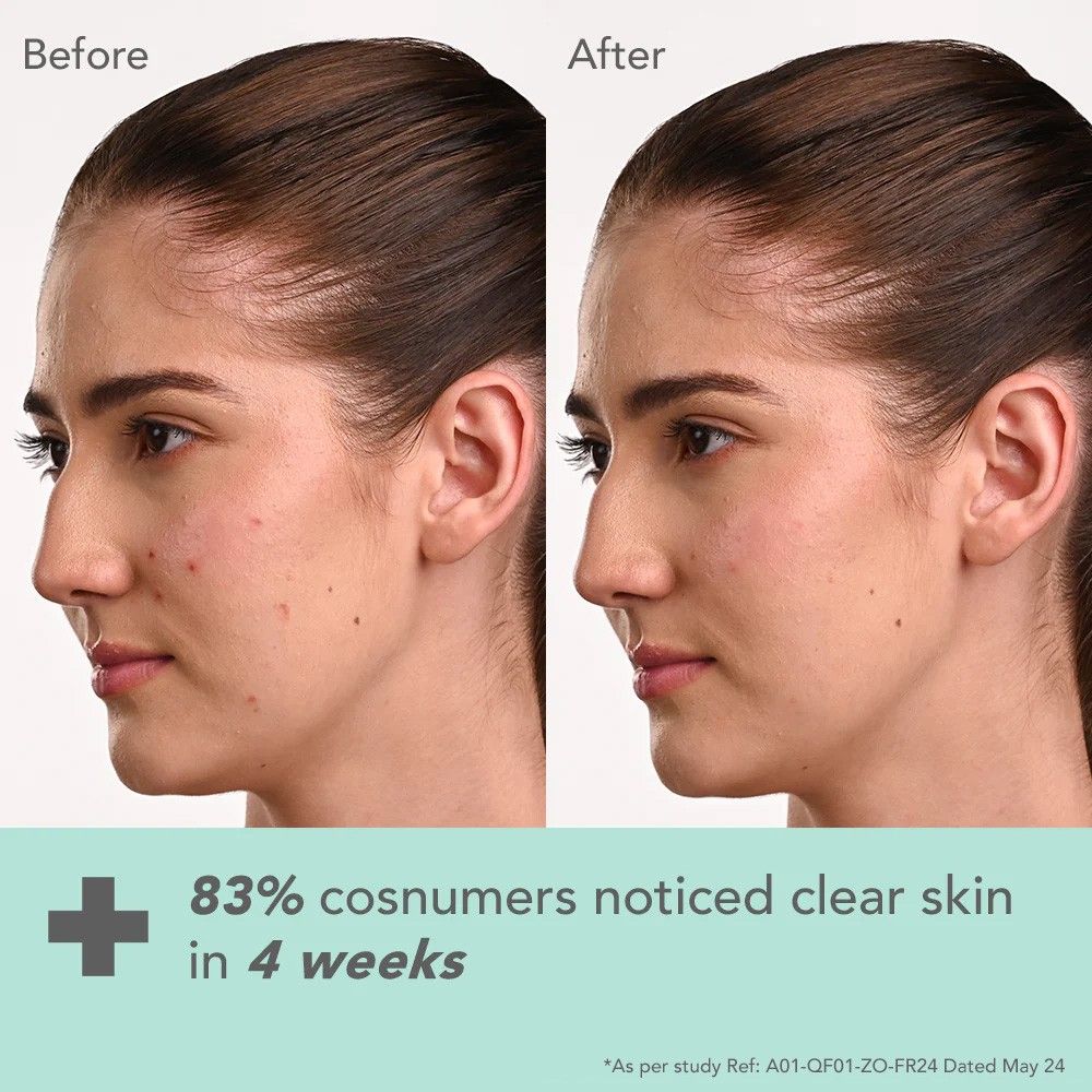 Lotus Dermabotanics Kojic Acid + Multi Berry Ampoule Face Cream pH5.5 Suitable For Sensitive Skin
