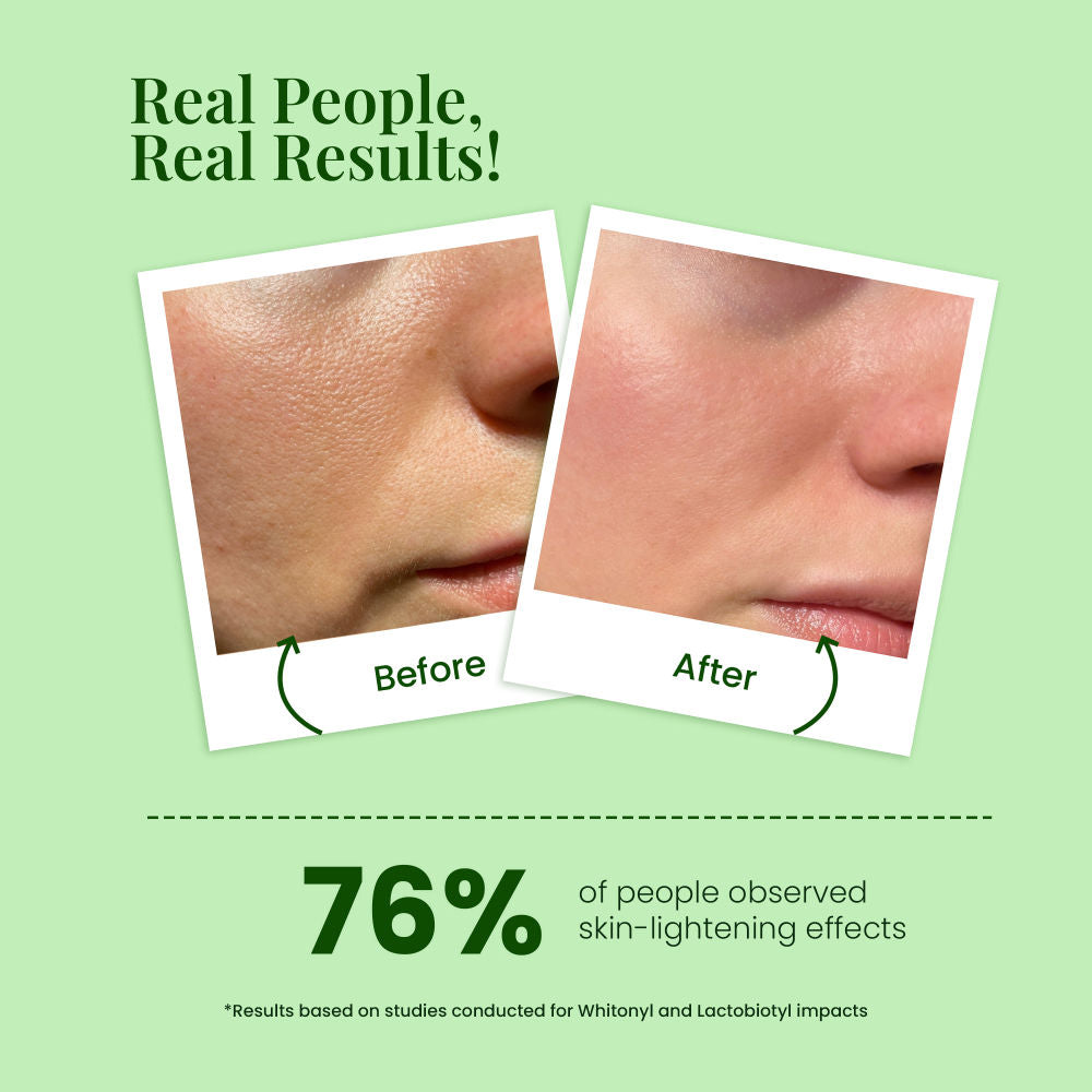 Vitamin C Face 2-In-1 Toner Serum 100% Alcohol Free For Refresh & Glowing Skin