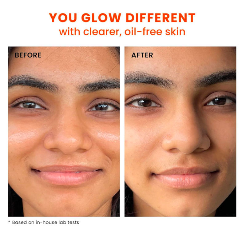 SPF 70 Gel-Cream Sunscreen for Oily Skin with PA++++ & Niacinamide