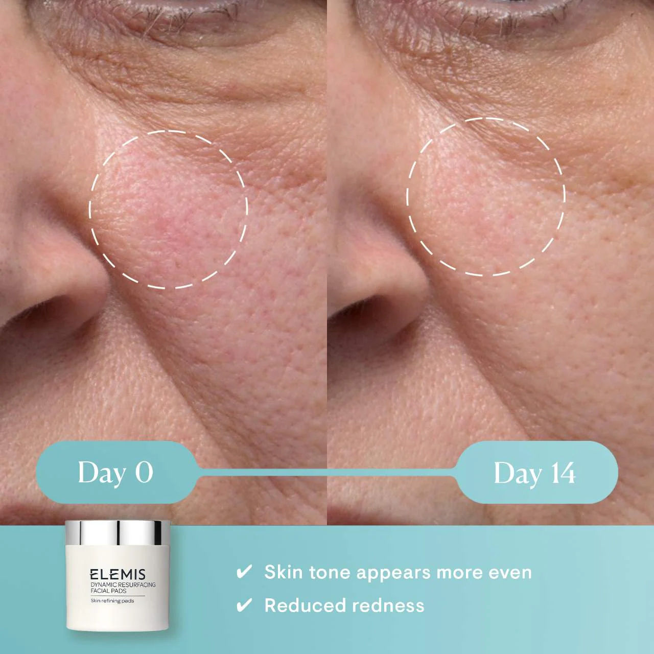 Dynamic Resurfacing Facial Pads