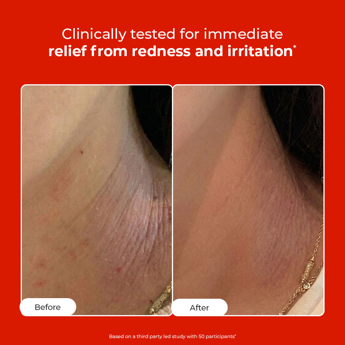 HOCL Skin Relief Face & Body Spray