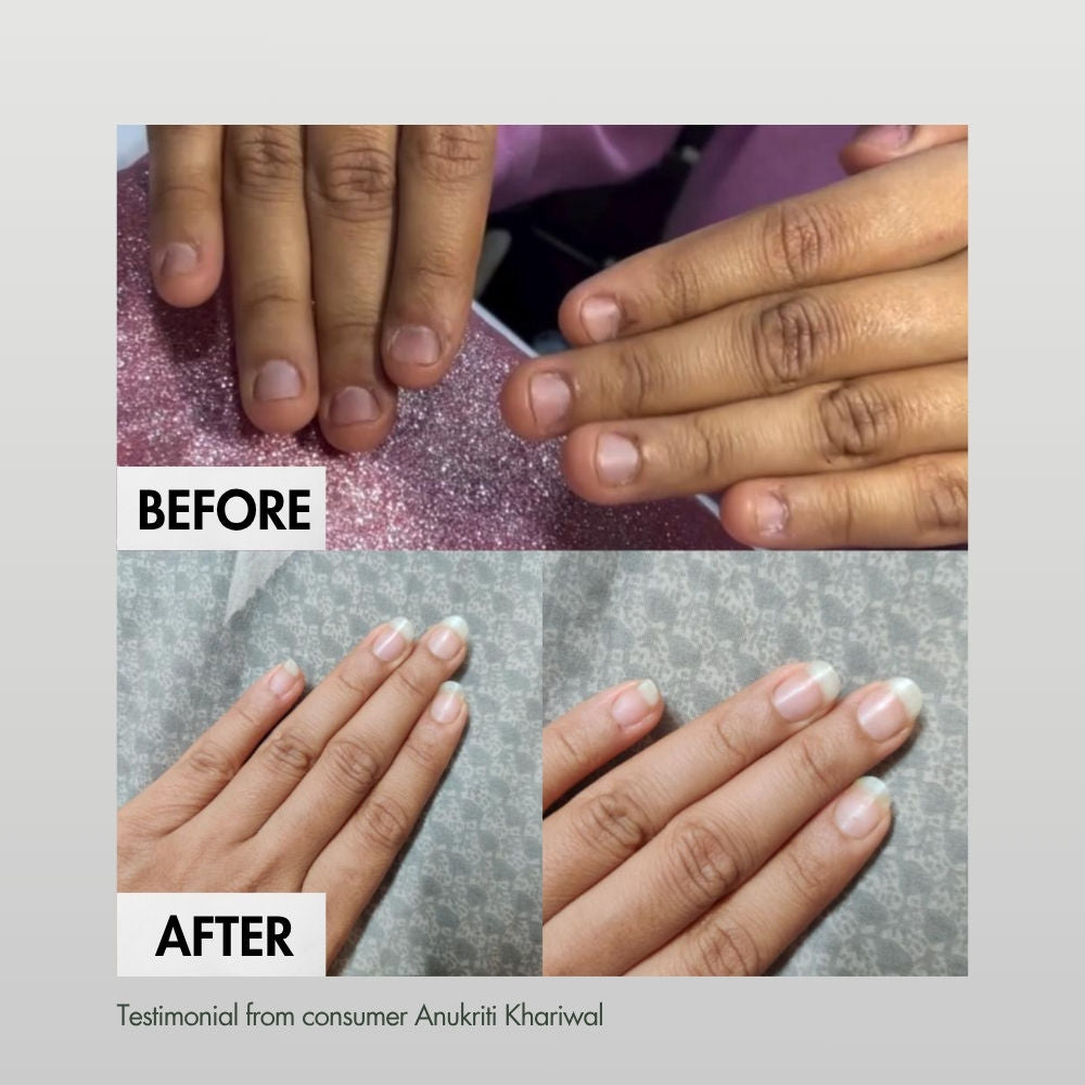 Nailed It Nail & Cuticle Treatment For Damaged, Brittle & Thin Nails