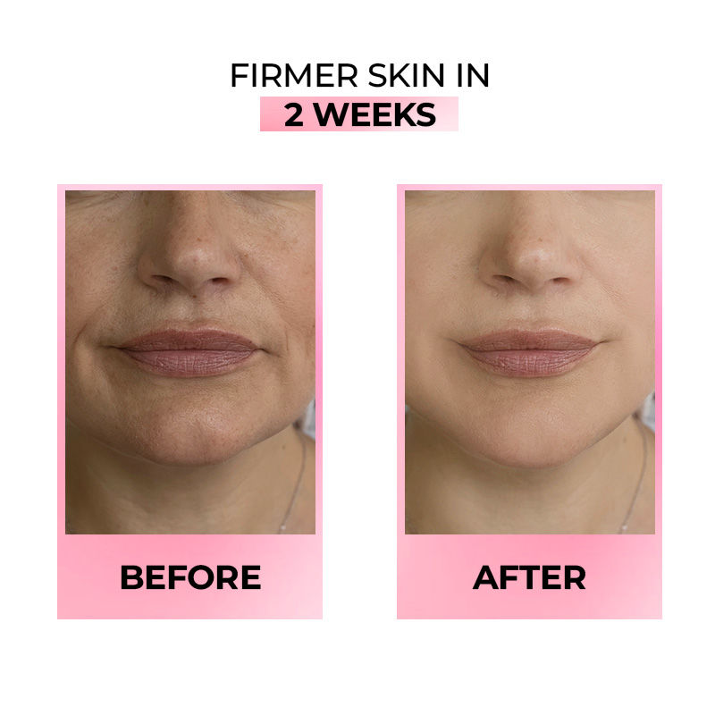 Youthful Shine Face Serum With 11% Retinol Peptide Complex, Reduces Fine Lines & Wrinkles