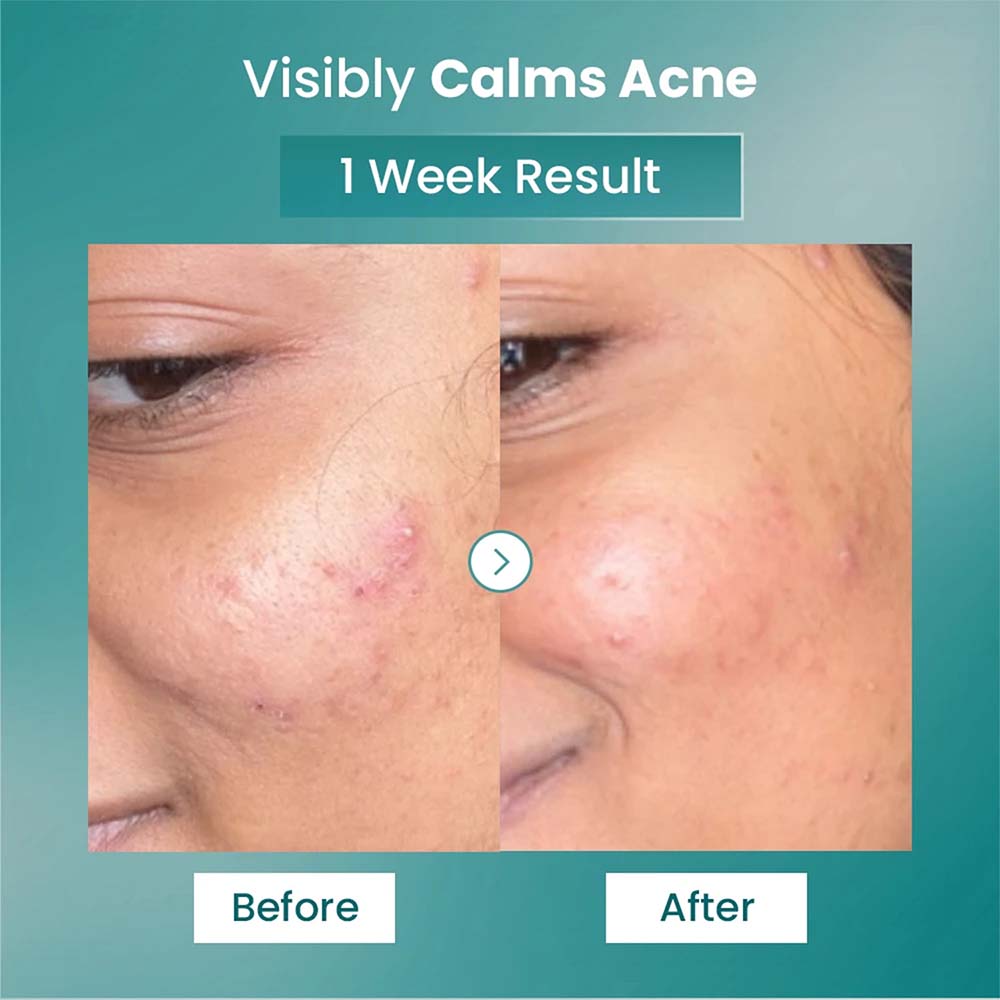 Spot Fade Advance Repair Serum