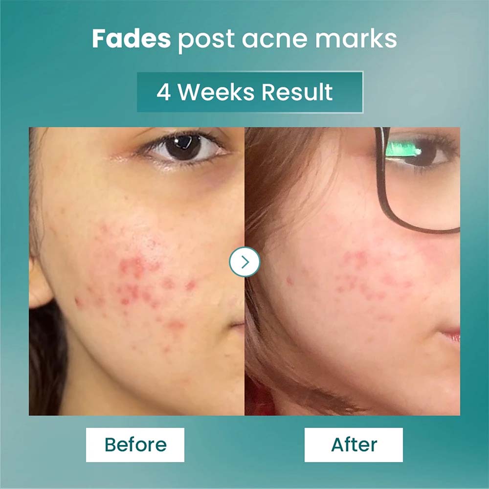 Spot Fade Advance Repair Serum