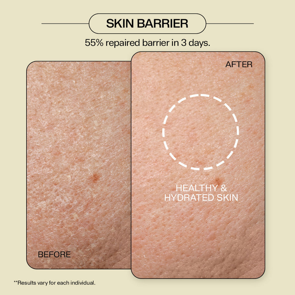 3 in 1 Skin Hydrator (Toner + Serum + Moisturizer) 1.4% Ceramides