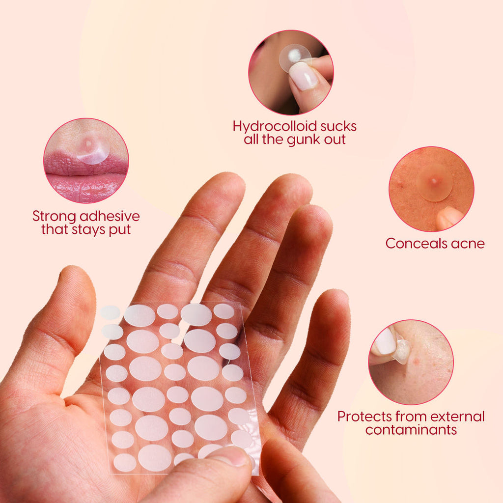 Acne Pimple Patches with Hydrocolloid - Face Spot Corrector Tape to Heal Acne, Prevent Scars