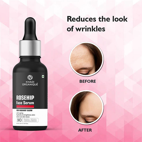 Rosehip Serum for Radiant Skin, Even Skin Tone, Hydration & Anti-Aging Care