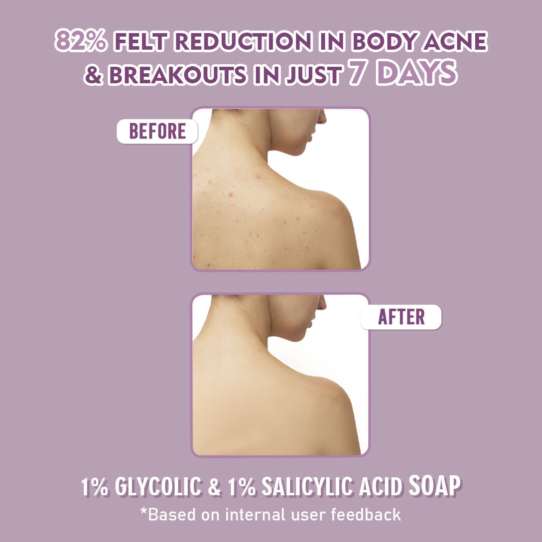 1% Glycolic Acid & 1% Salicylic Acid Body Acne Soap