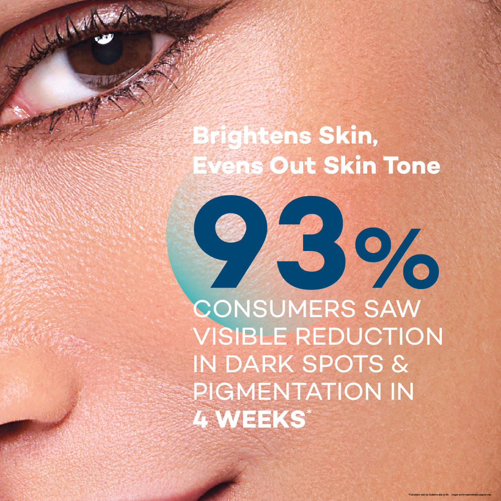 Radiance Serum with Niacinamide & Vitamin C, Reduces Pigmentation & Evens Skin Tone