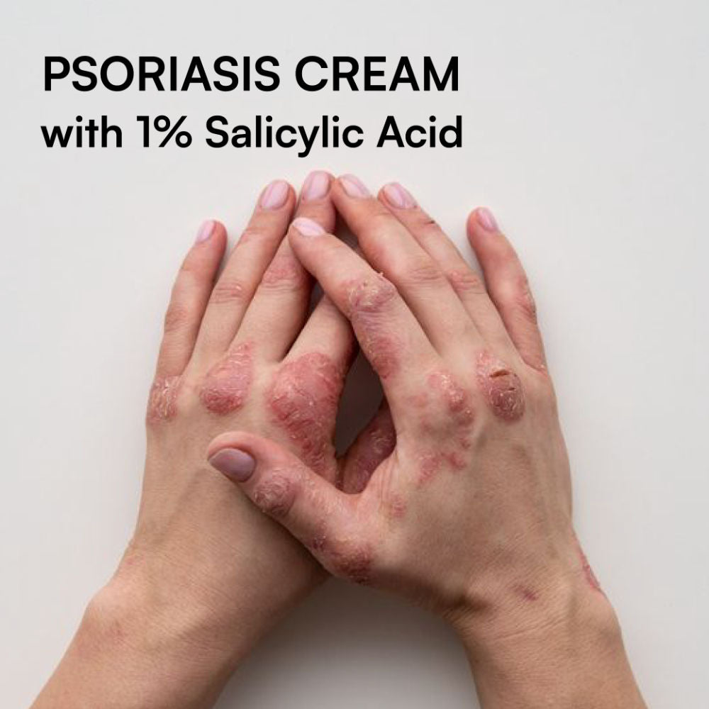 Psoramist Moisturizing Cream