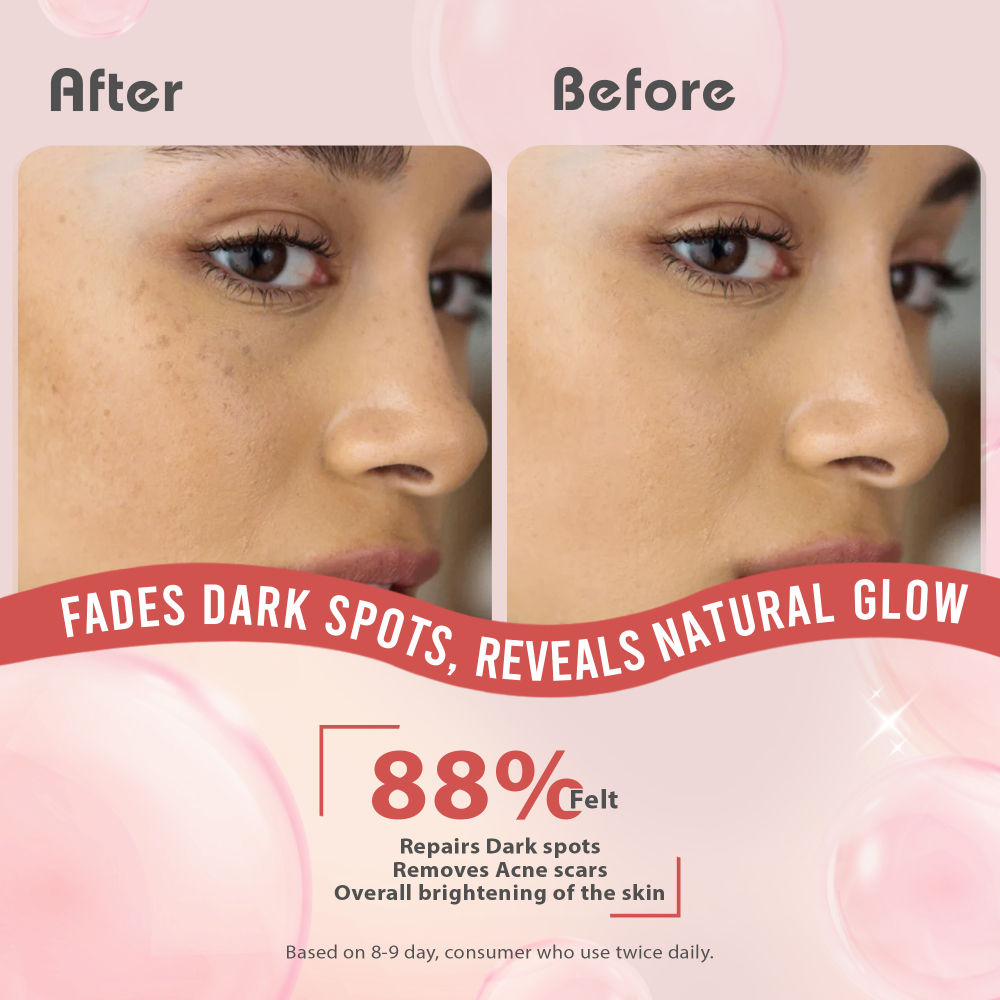 2% Kojic Acid Face Serum