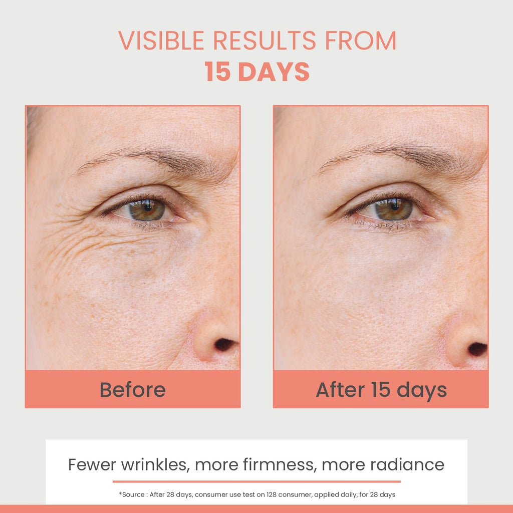 Hyaluron Activ B3 Renewal Firming Cream