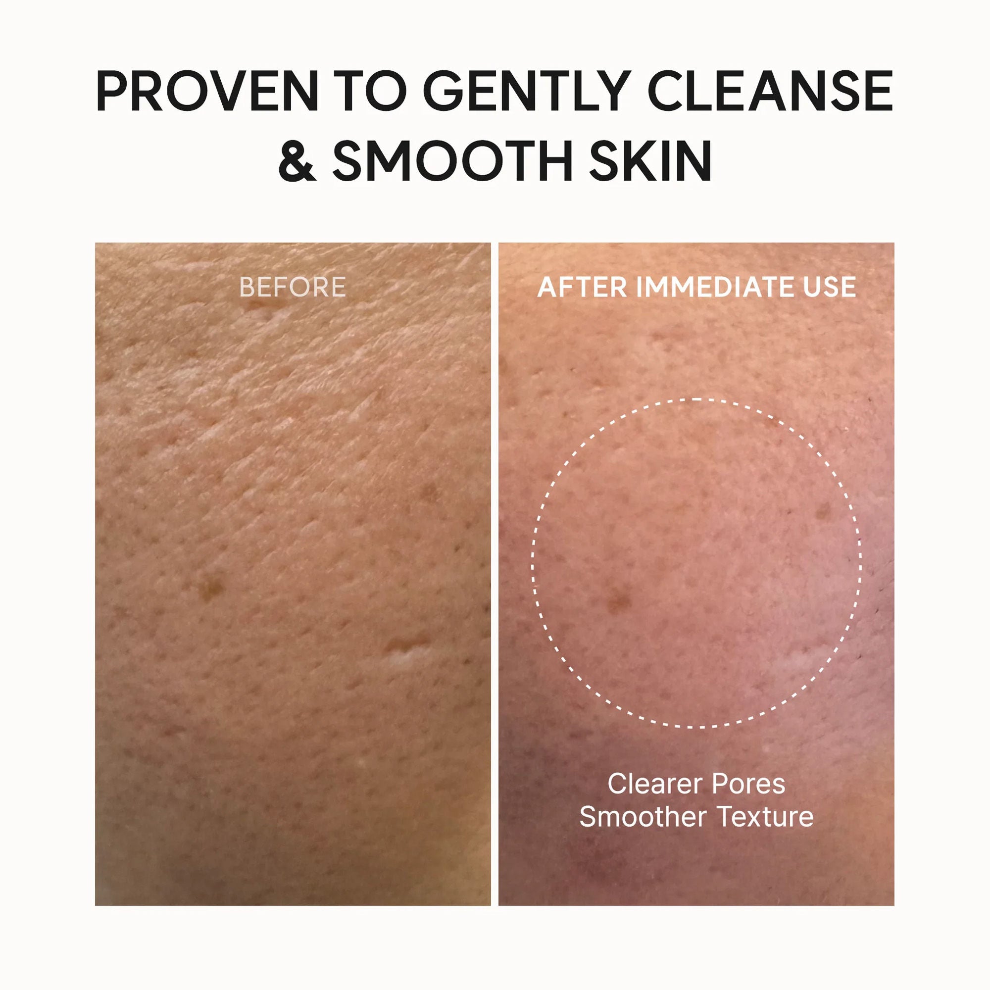 Fresh Rosehip Rice Mochi Cleanser - All-In-One Cleanser, Mask & Makeup Remover for Dull Skin