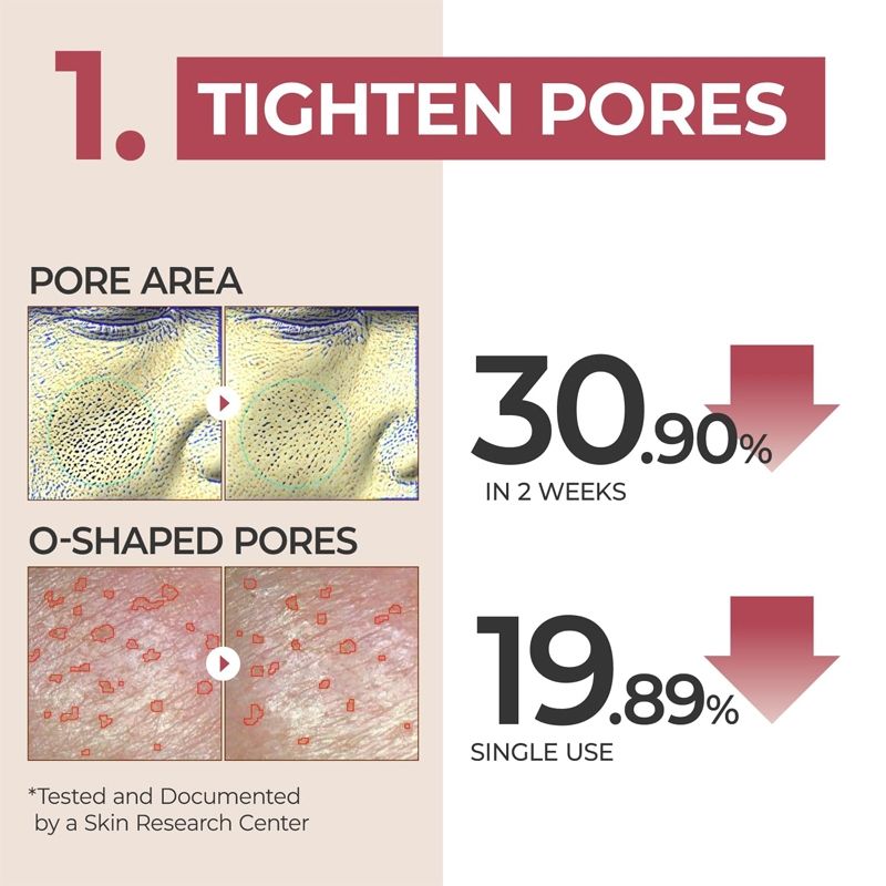 No.3 Skin Softening Serum, Pore Tightening Serum, Bifida & Galactomyces, Boosts Elasticity