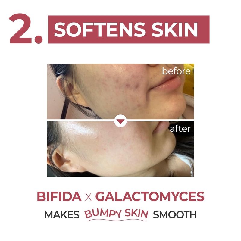 No.3 Skin Softening Serum, Pore Tightening Serum, Bifida & Galactomyces, Boosts Elasticity