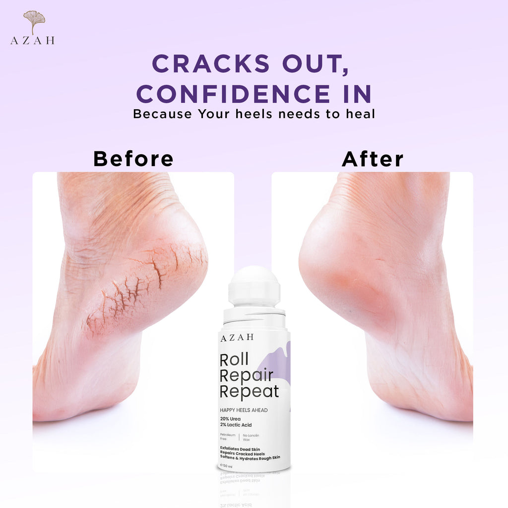 Foot Roll On For Cracked Feet - Exfoliates Dead Skin & Repairs Rough Feet