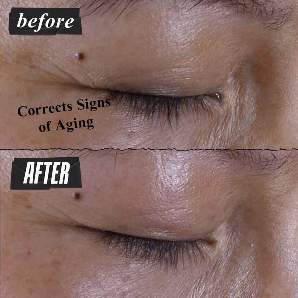 Super Multi-Corrective Eye Zone Treatment with Collagen Peptide & Proxylane