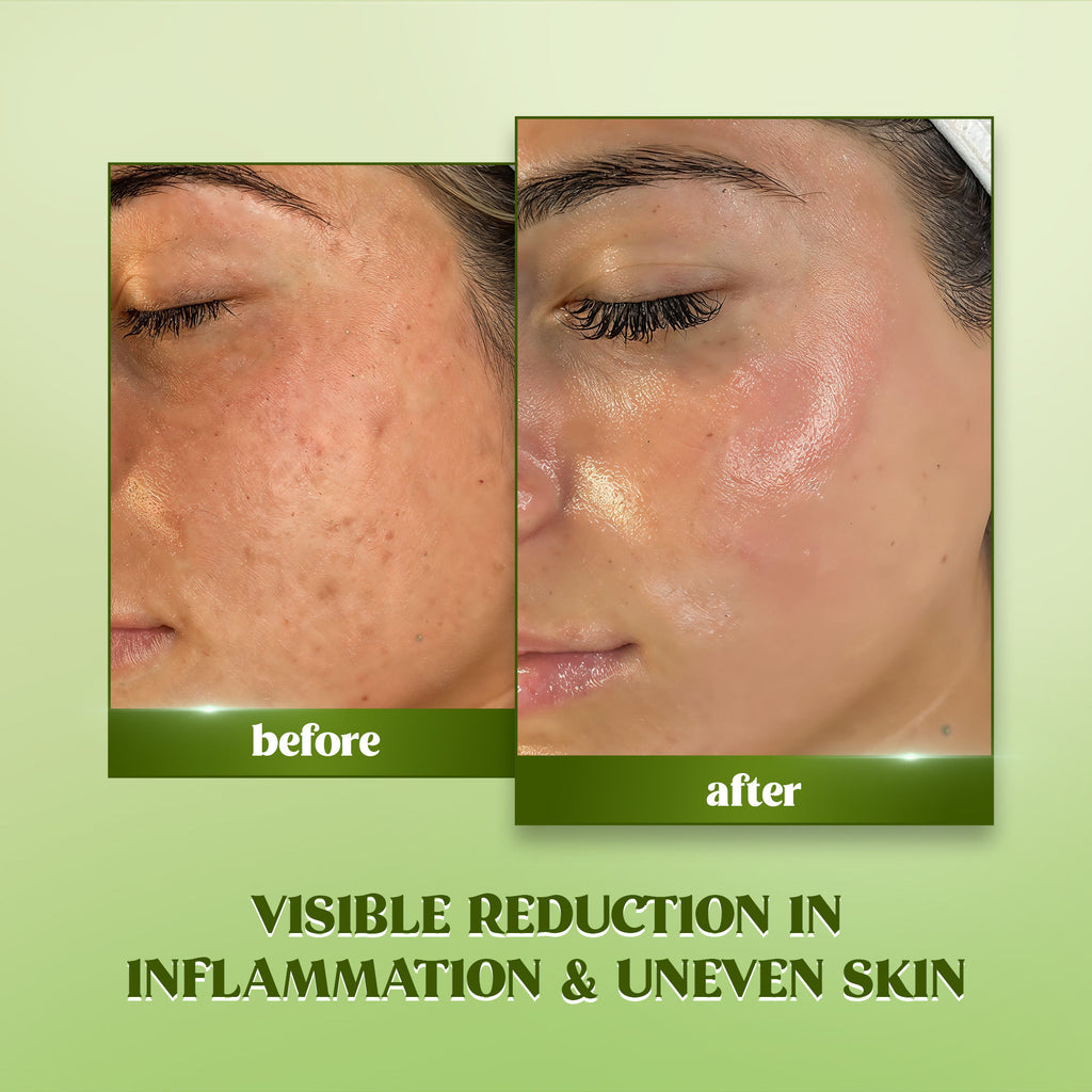 Matcha Serum