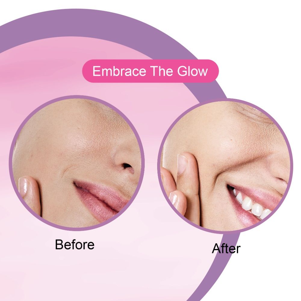 White Skin Face Serum Reduces Pigmentation, Dark Spots & Wrinkles