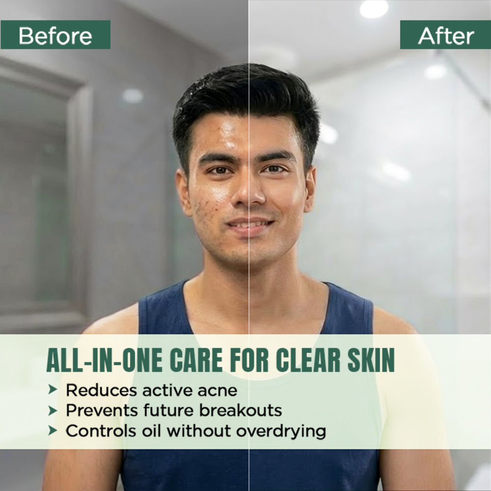 Anti Acne Face Wash
