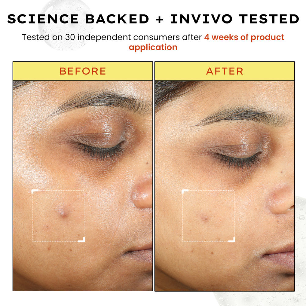 10% Vitamin C Serum with 1% Vitamin E & Ferulic Acid, Brightens & Fade Dark Spots