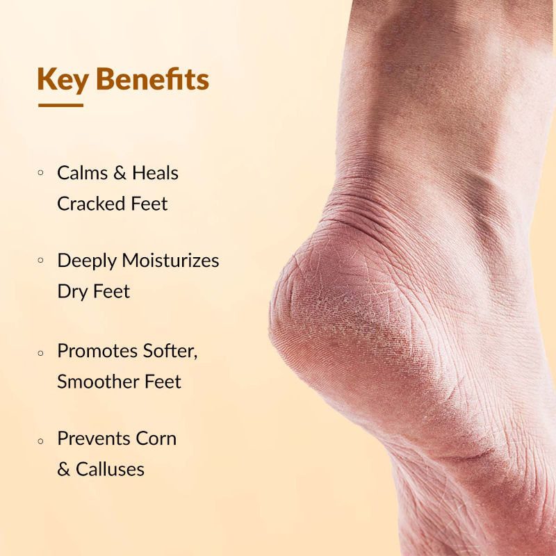 Foot Cream For Dry, Cracker Or Calloused Foot Skin
