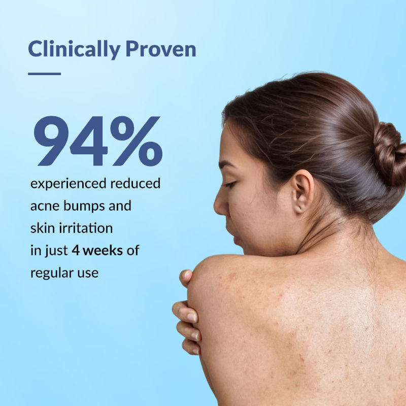 2% Salicylic Acid Salyzap Body Acne Spray