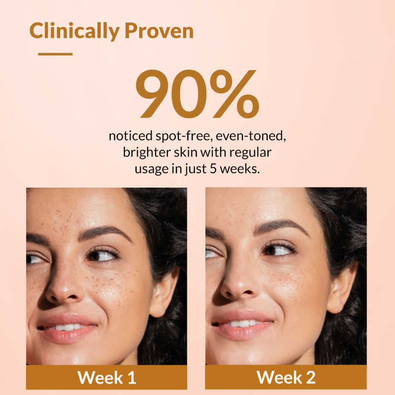 Kojic Acid + Arbutin Skarfix - Plus Cream