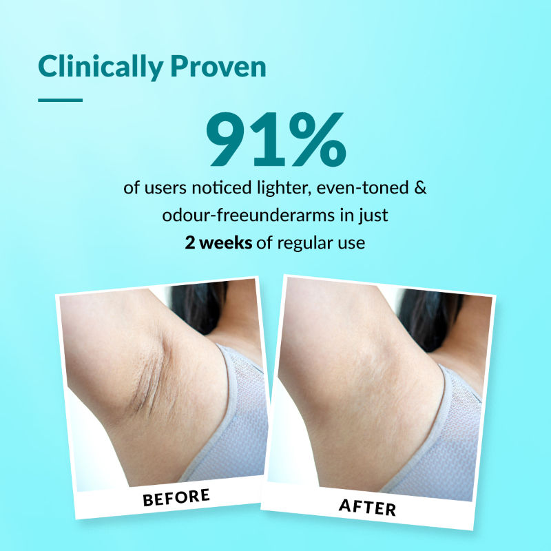 Nigrifix 6% AHA Underarm Lightening Roll On Ocean Fragrance