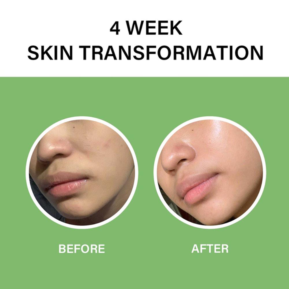The Real Noni Energy Ampoule, Calming, Hydrating & Glow Boosting Face Serum