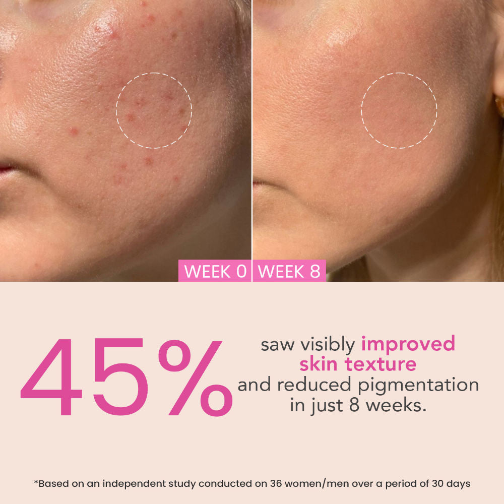 Night Repair Cream - Moisturiser For Brightening & Glow Boosting | Fades Finelines & Wrinkles