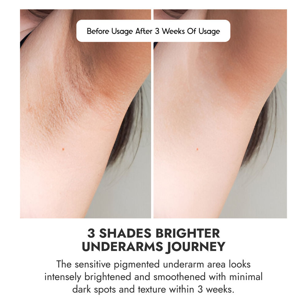 Brightening Underarm Roll On Serum For Women & Men