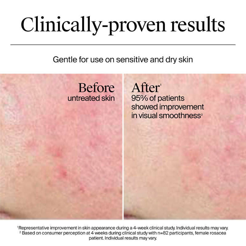 Hydro Boost Nourishing Cream Moisturizer with Hyaluronic Acid + Ceramides For Dry Skin