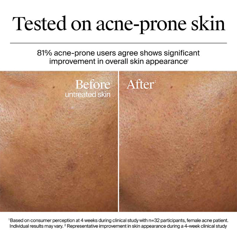 Hydro Boost Hyaluronic Acid Night Cream & Moisturizer with Peptide for Dry & Oily Skin
