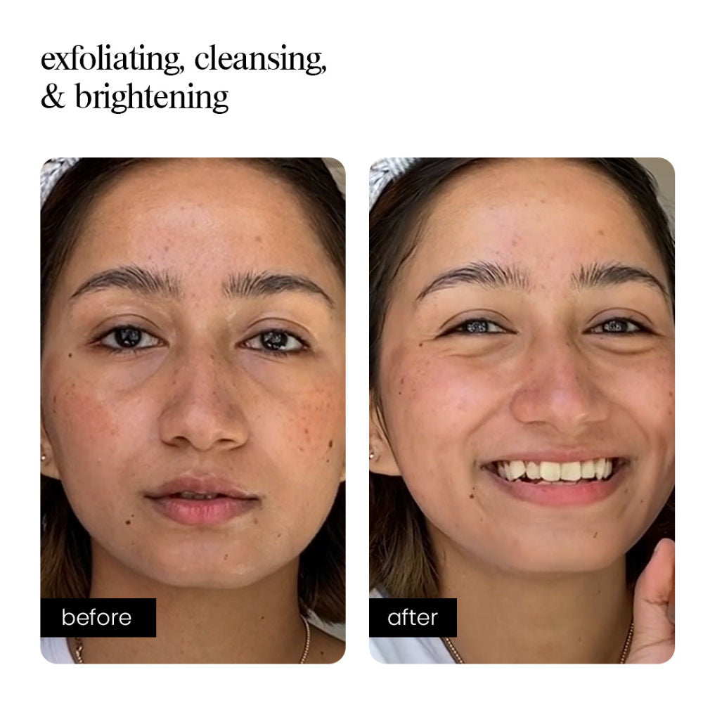 AHA Face Wash – Exfoliating & Brightening Cleanser for Dull Skin, Acne Marks & Dark Spots
