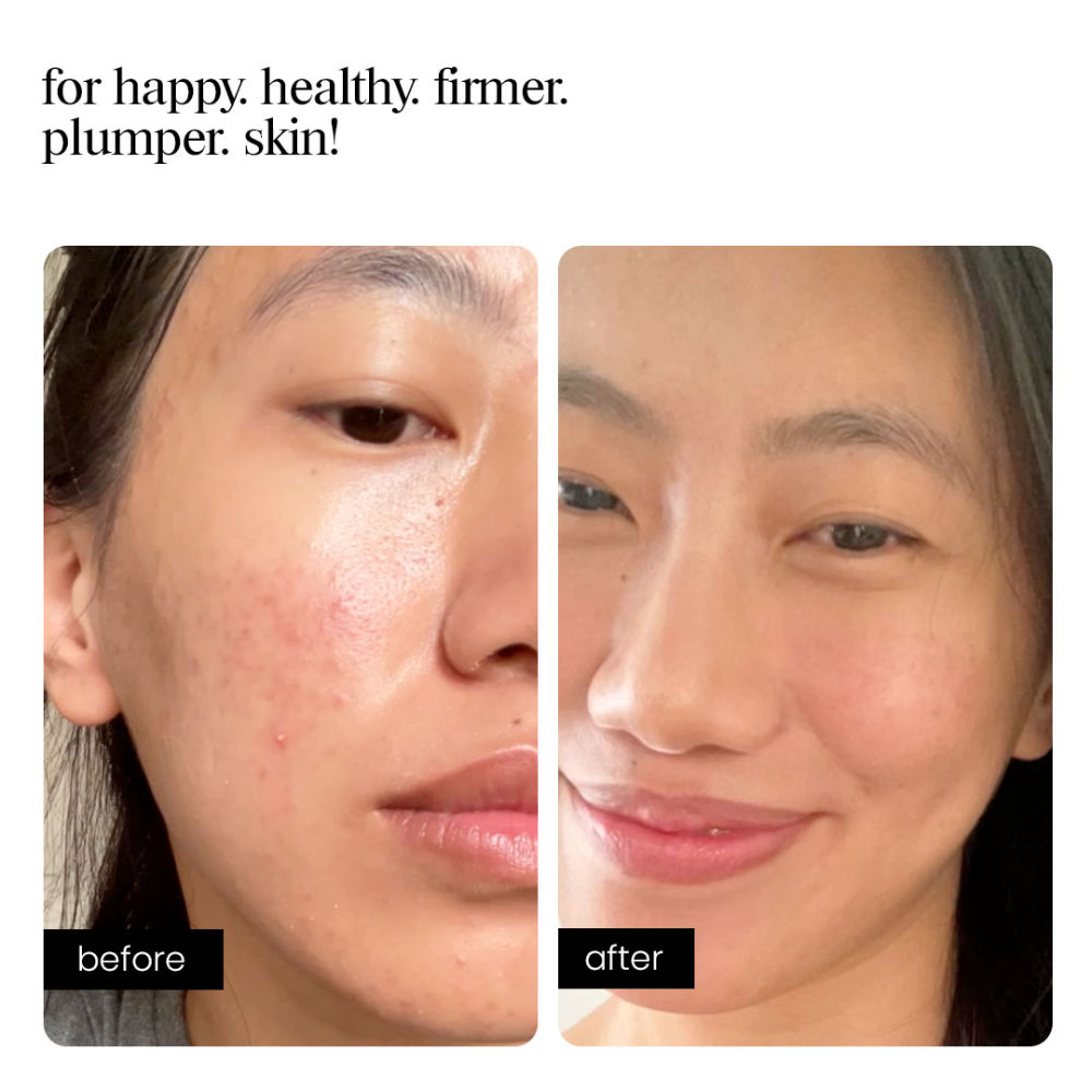 Copper Peptide Serum for Collagen Boost, Hydration, Firmness & Barrier Repair – DGA + Ectoin
