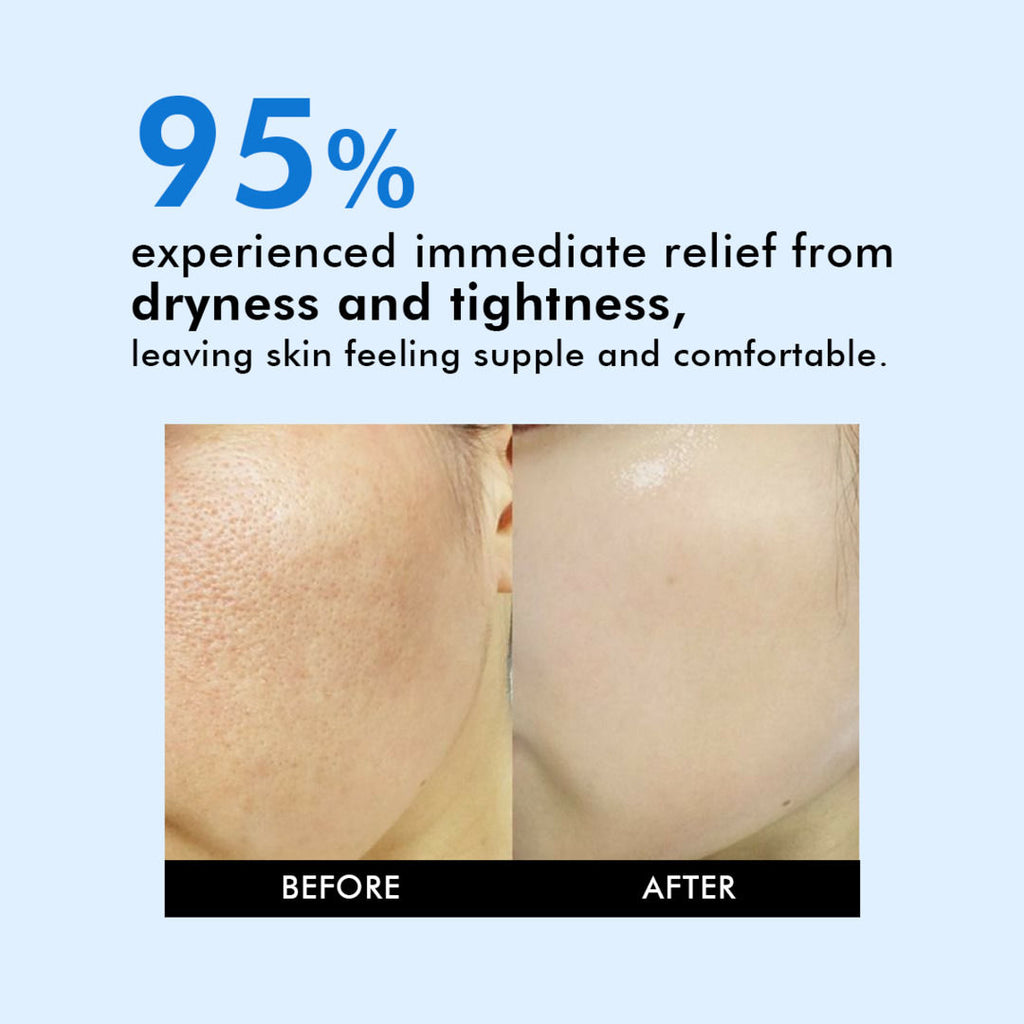 7 Ceramide Infused Milky Toner With Milk Protein & Niacinamide