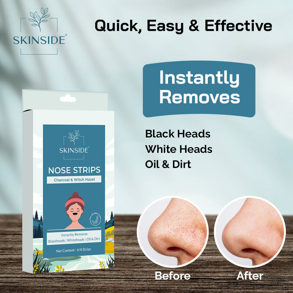 Nose Strips With Charcoal & Witch Hazel