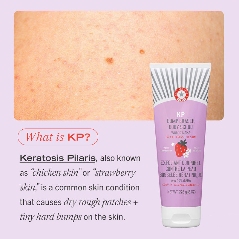 Strawberry KP Bump Eraser Body Scrub 10% AHA