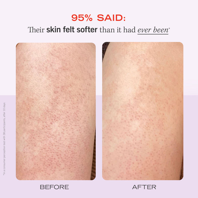 Strawberry KP Bump Eraser Body Scrub 10% AHA